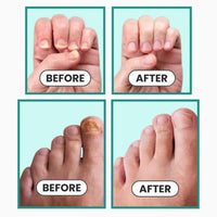 NailVital Device